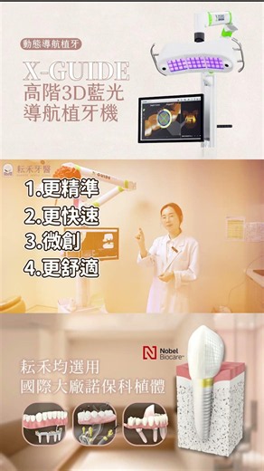 X-Guide 導航植牙｜微創、安心、精準的新世代植牙選擇
