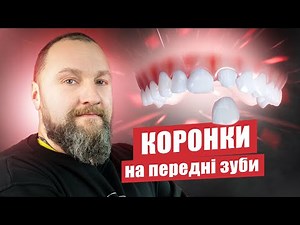🇺🇦 Коронки на передні зуби – які краще поставити?