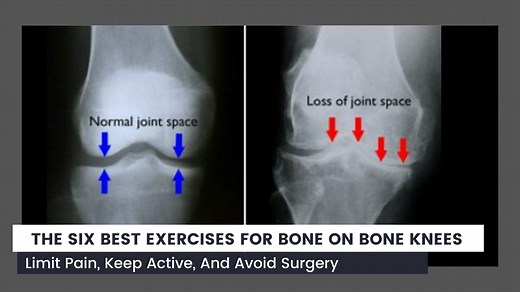 The Six Best Exercises For Bone On Bone Knee Pain — Solving Pain With Strength | Dr. Carl Baird