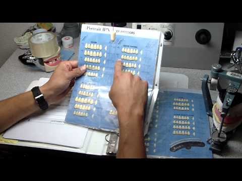 Dentures: How to Select Anterior Denture Teeth