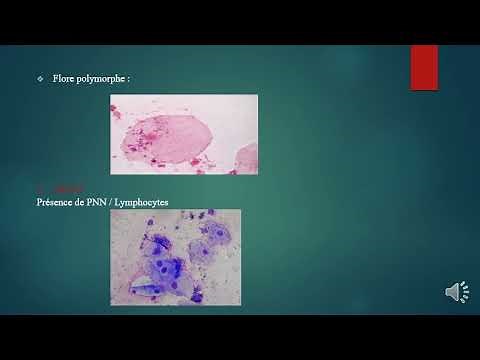 Examen Cytobactériologique du crachat (ECBC)