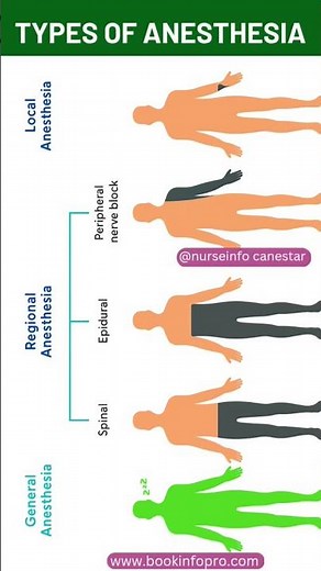 Types of Anesthesia #anesthesia #anesthesiatypes