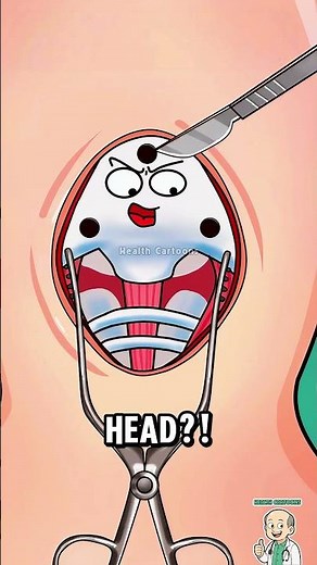 Inside a Craniotomy: Drilling the Skull! 🤯 #shorts