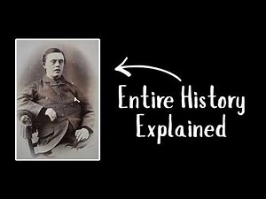 The Entire History Of Down Syndrome Explained