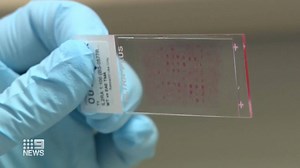 Researchers have discovered a new target for drugs, to fight an incurable disease that affects thousands of Australians. #9News | 9 News Sydney