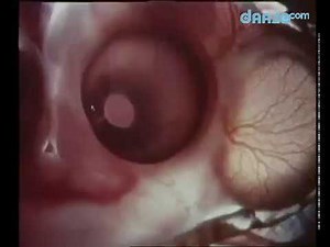 Overture (1965) - Short Film Palme d'Or, Academy Award for Best Documentary Short nominee