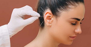 Auriculothérapie pour maigrir : comment se déroule une séance ?