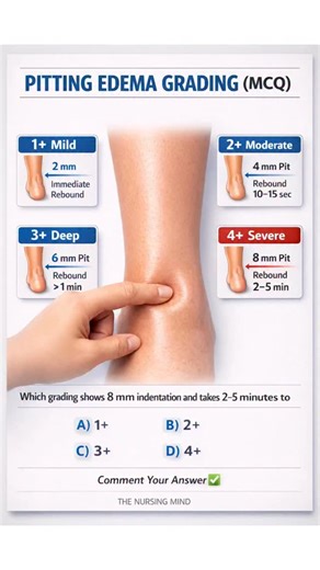 Pitting edema grading is a must-know NCLEX assessment skill 🩺✅ As a nurse, never just document “edema present”—always grade it 1 to 4 based on depth (mm) and rebound time. This helps identify conditions like CHF, kidney disease, liver cirrhosis, and low albumin states. 📌 Quick Tip: 2–4–6–8 mm = 1 to 4 🔥 ✅ MCQ Time: Which grading shows 8 mm indentation and takes 2–5 minutes to rebound? A) 1 B) 2 C) 3 D) 4 👇 Comment your answer! #NCLEX #NCLEXRN #NursingStudent #NurseLife #nclexpass | The Nursi