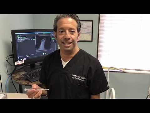 Ozone Injection for plantar fasciitis, gout attacks and Inflammation.