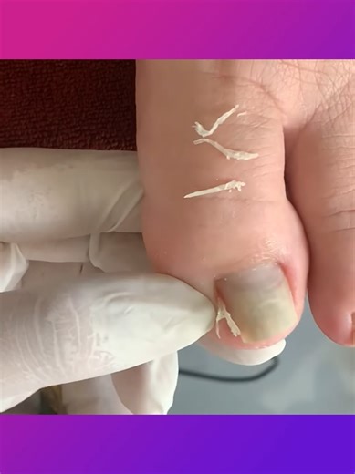 Satisfying Nail Restoration Transformation