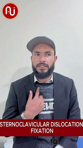 Patient Positive Review After Sternoclavicular Dislocation Fixation | Dr. Ashfaq Jadoon
