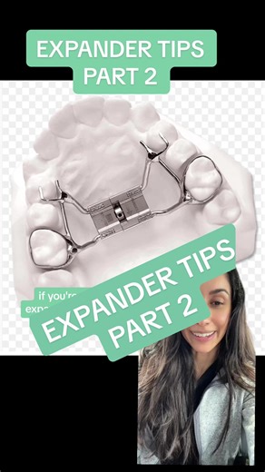 Understanding How Expanders Work for Effective Orthodontic Treatment