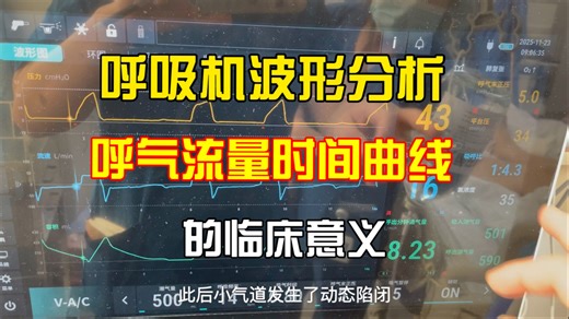 呼吸机波形分析：呼气流量时间曲线的意义。