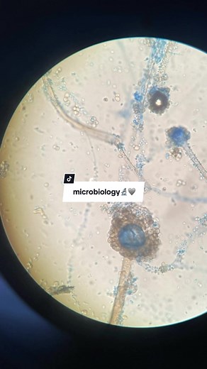 Kalah Cantik: Menyelami Dunia Mikrobiologi dan Bakteri