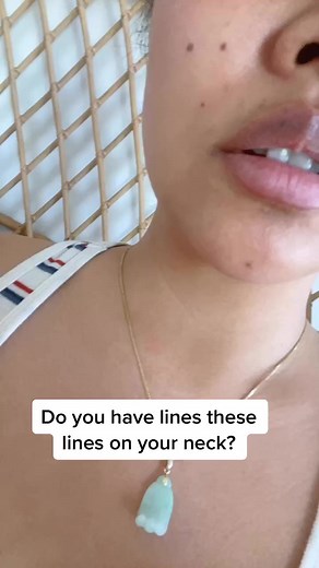 How to Get Rid of Neck Lines: Tips and Hacks