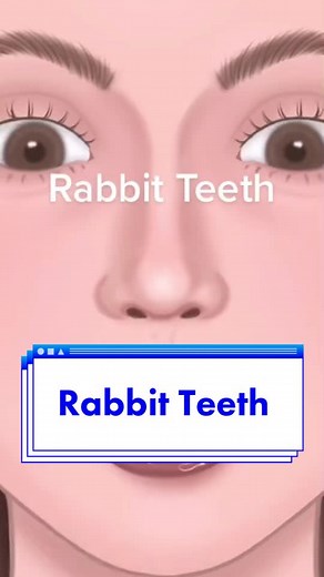 Fixing Rabbit Teeth: A Step-by-Step Guide