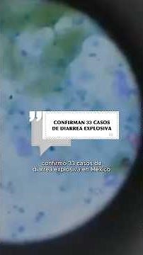 Confirman 33 casos de diarrea explosiva en México 🇲🇽