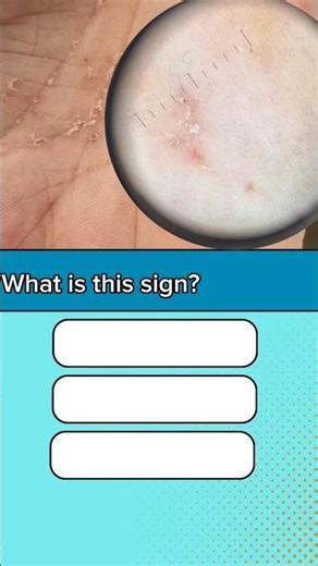 Dermoscopy quiz 3 #medsrudent #medacademy