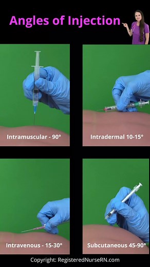 Angles of Injection Nursing: Subcutaneous, Intramuscular, Intradermal, and Intravenous When injecting a medication or starting an IV, you'll want to pay attention to the angle of Injection to ensure the solution is delivered to the appropriate tissue. IM is delivered into the muscle at a 90 degree angle. Subq can be 90 or 45. Intradermal is 10-15 degrees, and Intravenous is 15-30 degrees. #fyp #nursing #nurse #learnwithtiktok #nursingschool