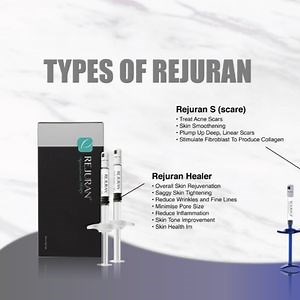[Hot Item] 2025 Korea New Factory Price Rejuran Injection Remove Acne Scars 1ml Pn Pdrn Contain DNA Dermal Filler Rejuran Pn Rejuran Healer