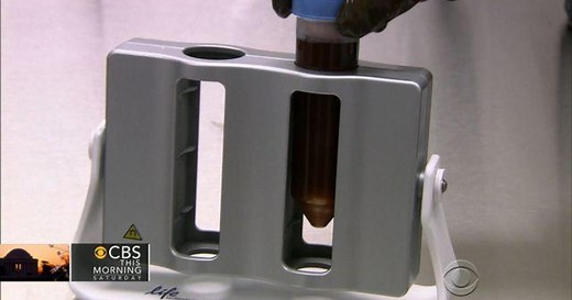 Major breakthroughs in HIV treatment announced