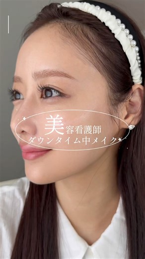 【ダウンタイム中メイク】美容看護師の“治療痕”をしっかりカバーするメイク🎀 #美容 #美容皮膚科 #肌育 #beauty #ヒアルロン酸 #垢抜け #メイク #コンシーラー