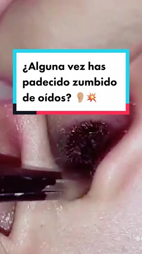 ¿Frecuentemente escuchas zumbidos en el oído? Te platico a qué se deben 👂🏼 #zumbido #oidos #audiologia #aprendeentiktok #hospitalesmac #doctormac