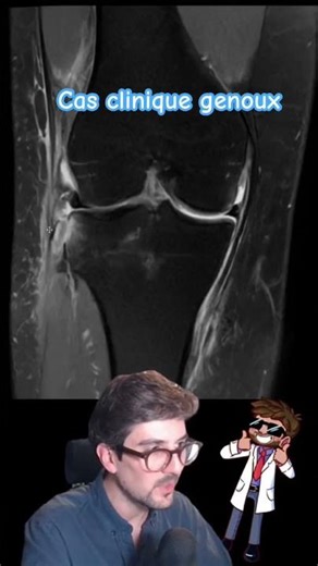 Cas clinique radiologie: genoux. #radiology #doctor
