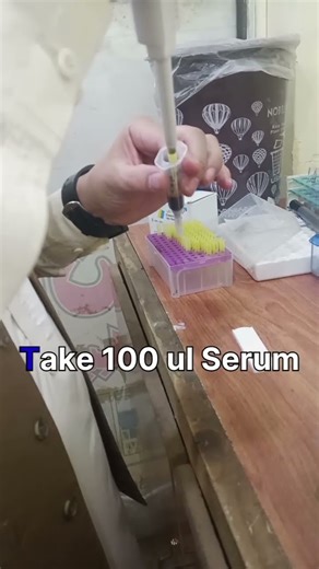 HBS Test Full Procedure #laboratory #trending #unboxing #hematology #serology #oncology#labchannel