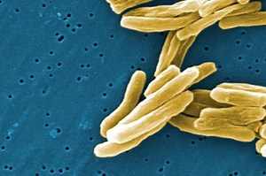 What is Tuberculosis?