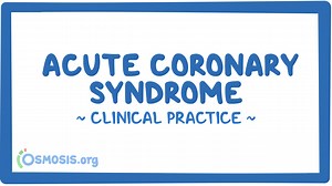 Acute coronary syndrome: Video & Meaning | Osmosis