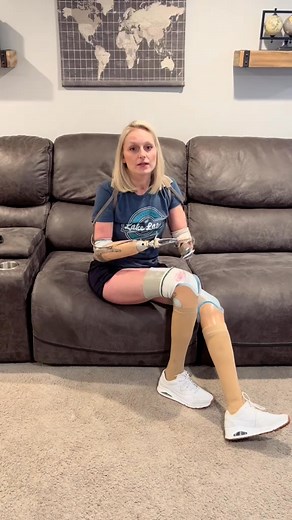 Here’s how I put on my prosthetic arms! #prosthetic #amputee #quadamputee #prosthetics #ot #occupationaltherapy #disabilitytiktok #howtotiktok #amputeelife #amputeegirl #amputeetiktok #fyp | Glamputee