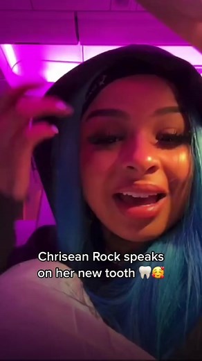 What if i told you Chrisean Rocks new tooth will RUIN her smile! 😭😳🦷 lets find out why 👀 #teeth #chriseanrock #health #reaction