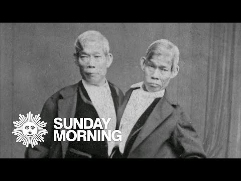 "Mobituaries": Chang and Eng Bunker, the original Siamese twins