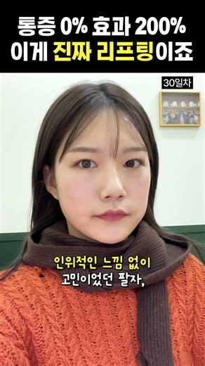 통증 없는 써마지 리프팅? #써마지 #쿨페이즈 #레이저리프팅