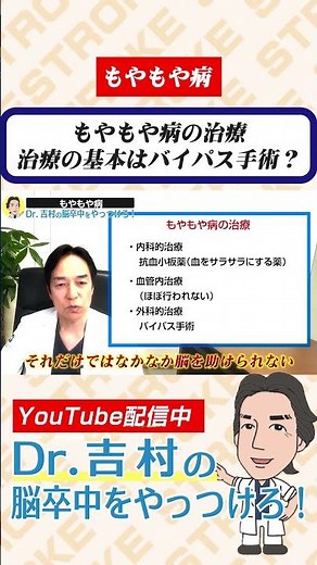 もやもや病の治療 治療の基本はバイパス手術？ #もやもや病 #バイパス手術 #脳出血 #脳卒中 #くも膜下出血 #兵庫医科大学 #医学生 #研修医