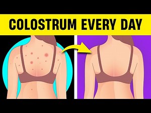 Ten Powerful Reasons You Should Use Colostrum Every Day