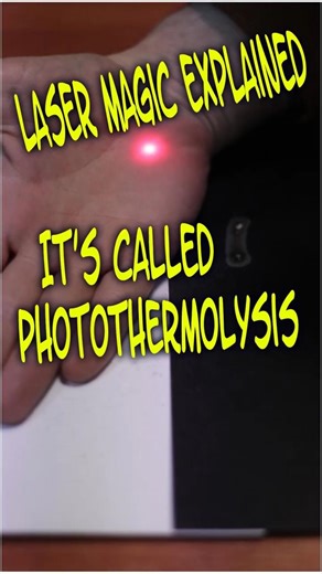 Selective Photothermolysis: Why it doesn't burn skin?