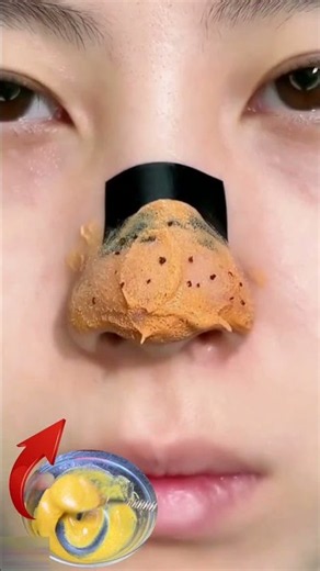 Remove Blackheads & Whiteheads Fast 👃✨ Get cleaner pores and smoother looking skin naturally 🧖‍♀️�