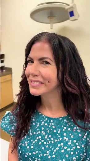 Dimple creation #transformation #cosmeticsurgery