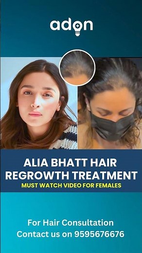 Alia Bhatt Female Pattern Grade 2 Baldness | Hair Loss | Hair Treatment | Adon Hair Care #viral