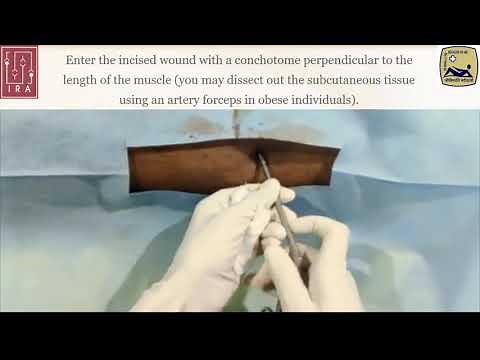Muscle Biopsy
