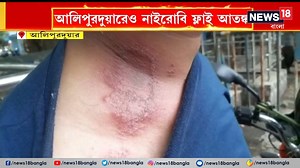 Nairobi fly : নাইরোবি ফ্লাইয়ের আতঙ্ক ধূপগু়ডিত ও আলিপুরদুয়ারেও ! শহরের একাধিক জায়গায় নাইরোবি ফ্লাই ঘিরে আতঙ্ক। মুখ, চোখ, হাতে পতঙ্গটি বসলেই বিপদ | News18 Bangla