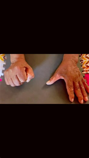 ¿Qué es la atrofia muscular? Es la disminución del tamaño y la fuerza de los músculos debido a la pérdida de tejido muscular. Esta afección puede ser el resultado de enfermedades neuromusculares, desuso prolongado, lesiones o envejecimiento. 🌸Causas Enfermedades neuromusculares Inmovilidad Envejecimiento Mala nutrición Secuelas de lesiones 🌸Síntomas Debilidad muscular Dificultad para moverse o realizar actividades físicas Pérdida de masa muscular visible Cambios en la postura y equilibrio Cala