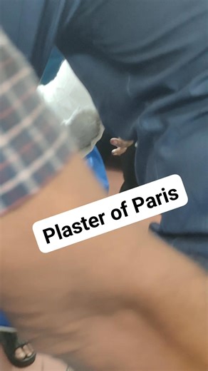Plaster of Paris (POP) is used to immobilize a leg fracture by creating a rigid cast that holds the bone in place while it heals. | Anik Chandra Dey