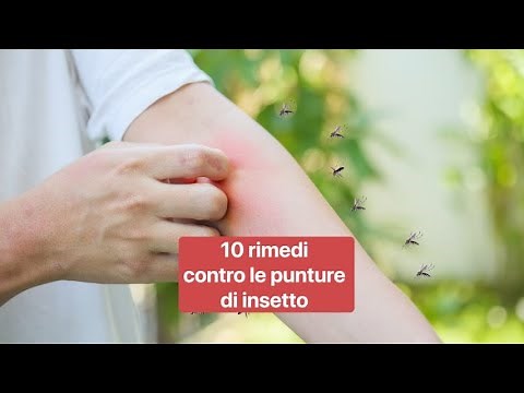 Come curare le punture e i morsi d’insetto: 10 rimedi della nonna