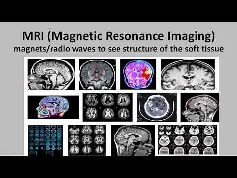 Brain Scans--A Comparison