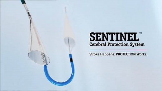 SENTINEL™ Cerebral Protection System Animation