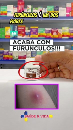 Tratamento de Furúnculos com Pomada Beladona - Saúde e Vida