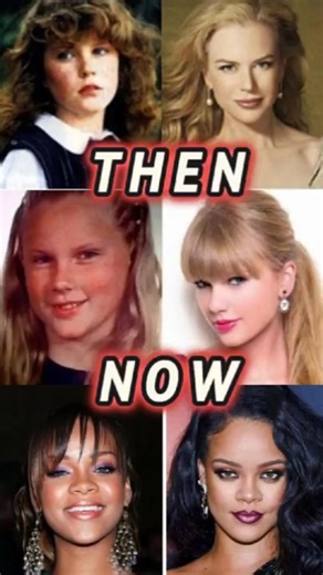 Then and Now You Won’t Believe GL 535